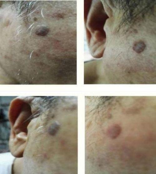 聚焦全国2026两会报道 现代科技量氢氧元素绿色自然疗法！(廖永贵院士)