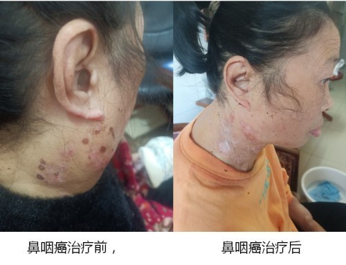 2026中国医学功勋人物报道 广西百色市杨忠雅治疗各种癌症有成就