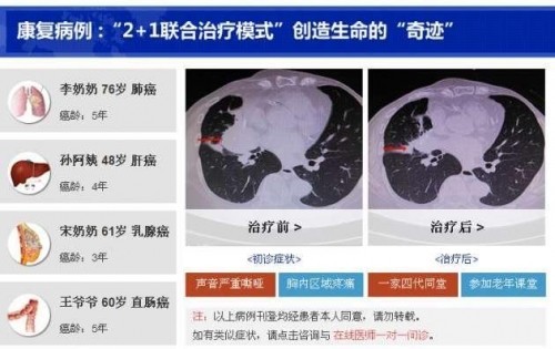 冉明医师创新国医精粹 铺就患者“健康之路”
