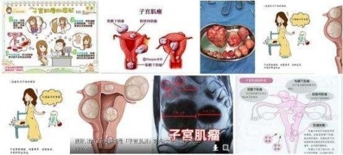 冉明医师创新国医精粹 铺就患者“健康之路”