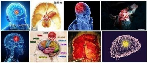 冉明医师创新国医精粹 铺就患者“健康之路”