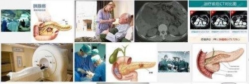 冉明医师创新国医精粹 铺就患者“健康之路”