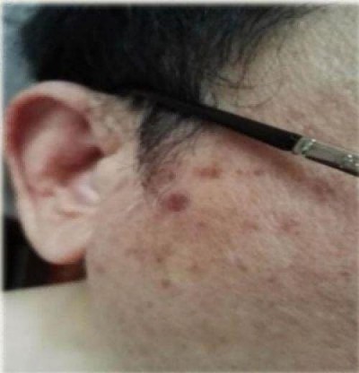 量子氢氧健康第一人长寿哥(廖永贵)  让科学量氢氧品牌走向世界!