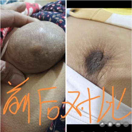 守医者初心 传针挑薪火——记李氏古针挑疗法第五代传承人李新强